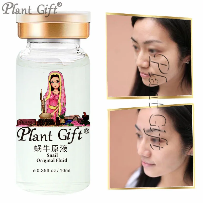 

10 * 2 . 10 Anti