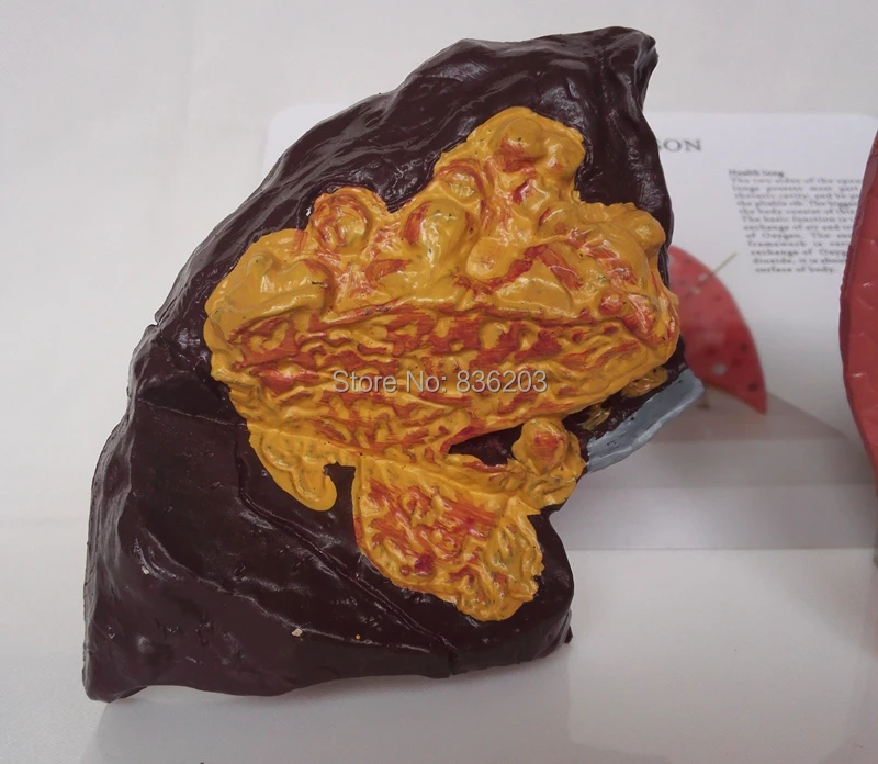 Медицинский шприц для обучения при раке легких|lungs model|human lung modelmodel lungs |