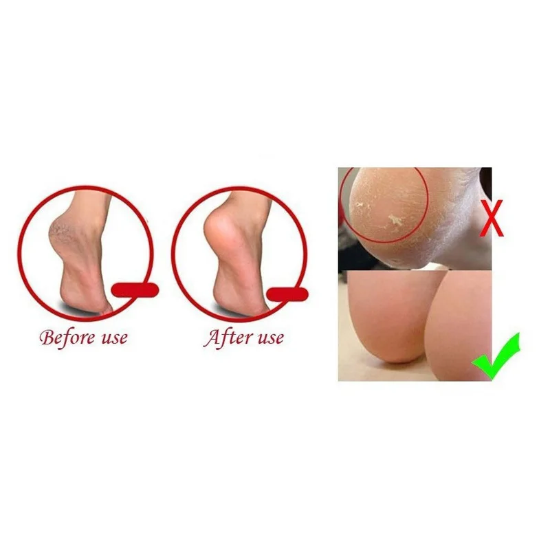 1 пара силиконовые носки для педикюра с подушками|feet care|silicone gel feetheel cushion socks |