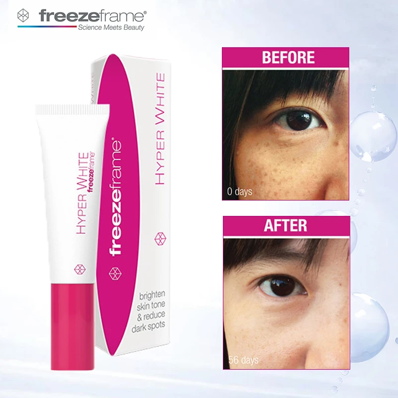 

Freezeframe Face Solution Hyper White Cream Brightening Skin Tone Reduce Dark Spots Pigmentation Darkness Color Correct Cream