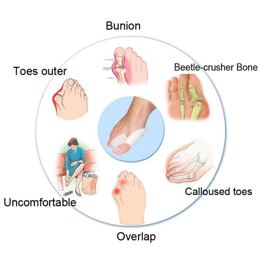 

2pcs Silicone Foot Massager Toe Separator Fingers Thumb Valgus Protector Bunion Adjuster Hallux Valgus Guard Feet Care Z27601