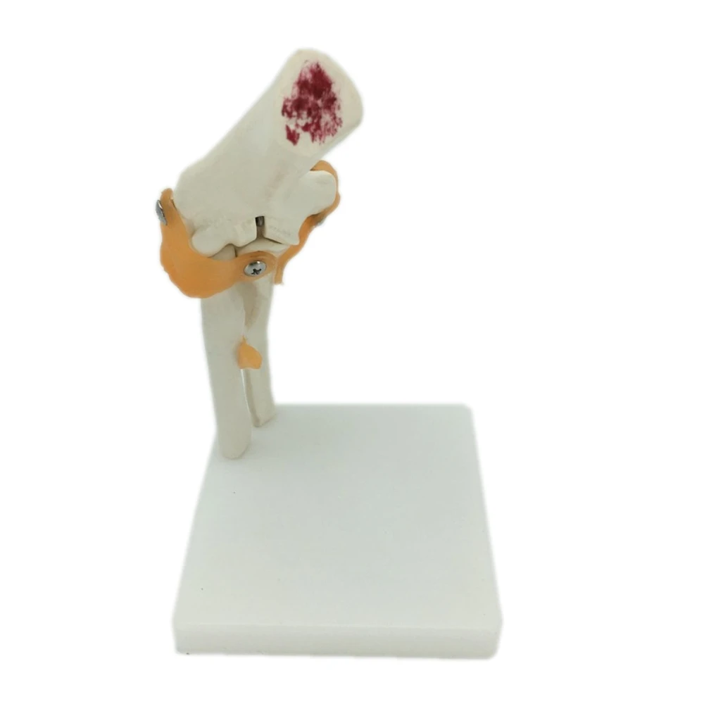 Полноразмерная модель коленчатого сустава человека анатомическая медицинская