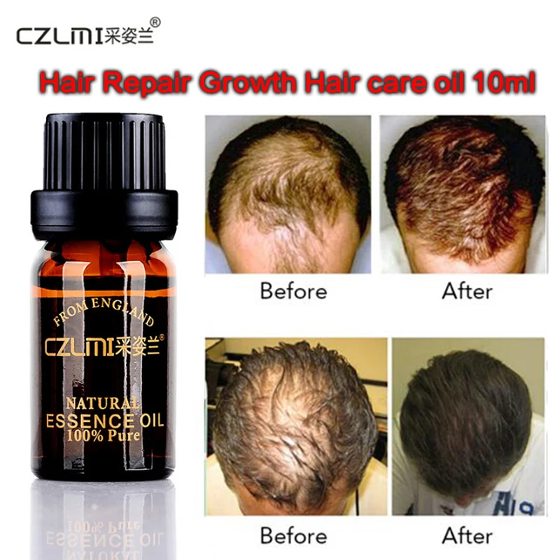Hair Care Fast Powerful Hair Growth Products Regrowth Essence Liquid Treatment Preventing Hair Loss for Men Women 10ml Oil