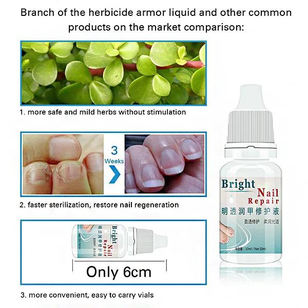 Горячая 2 шт Анти грибковое лечение Экстра прочность ногти грибок спортсменов