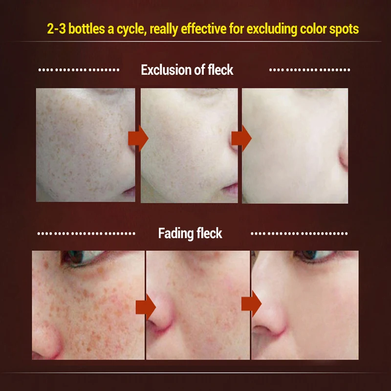 MEIKING крем для лица Уход за кожей осветляет отбеливающий Антивозрастной дневной