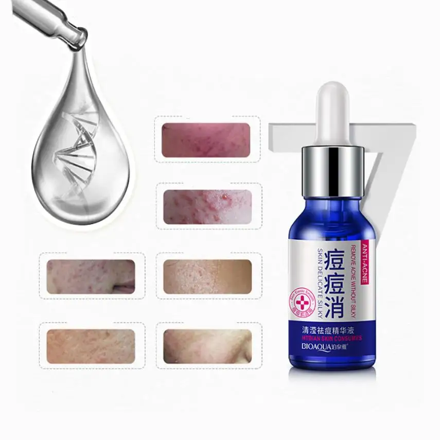2018 гарантия качества уход за кожей лица решение акне пятна шрам удаление пятен