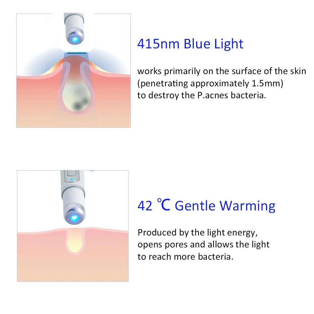 Personal Care Facial Beauty Device Portable Blue Light Gift Acne Pen Cosmetic White Scar Wrinkle Removal Anti-Aging