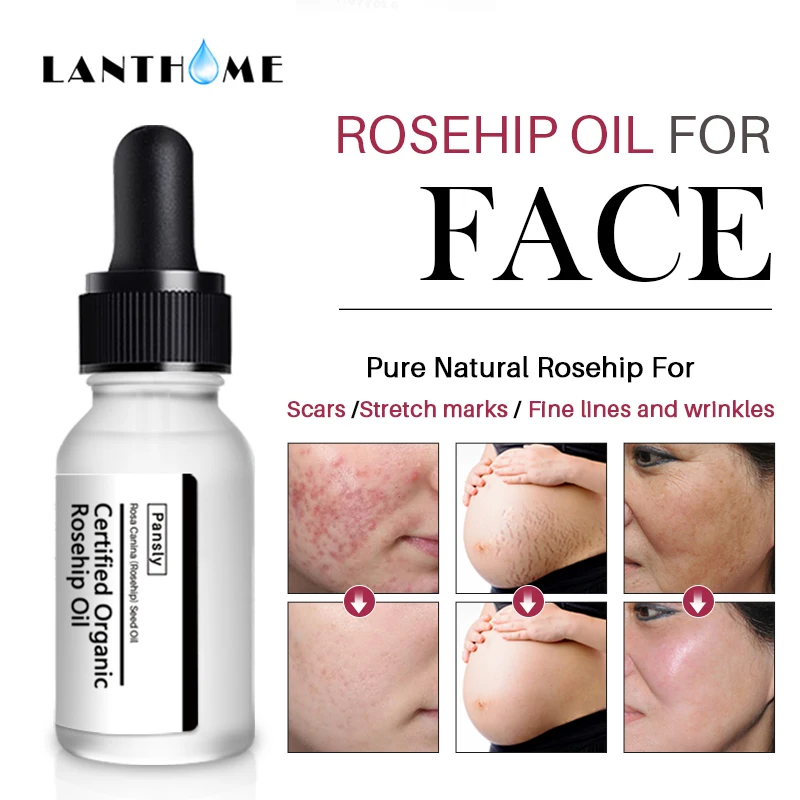 2 шт. антивозрастной органический чистый масло шиповника анти шрамы тонкие