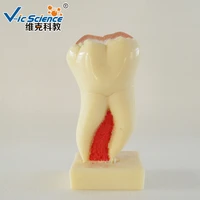 anatomical molar model