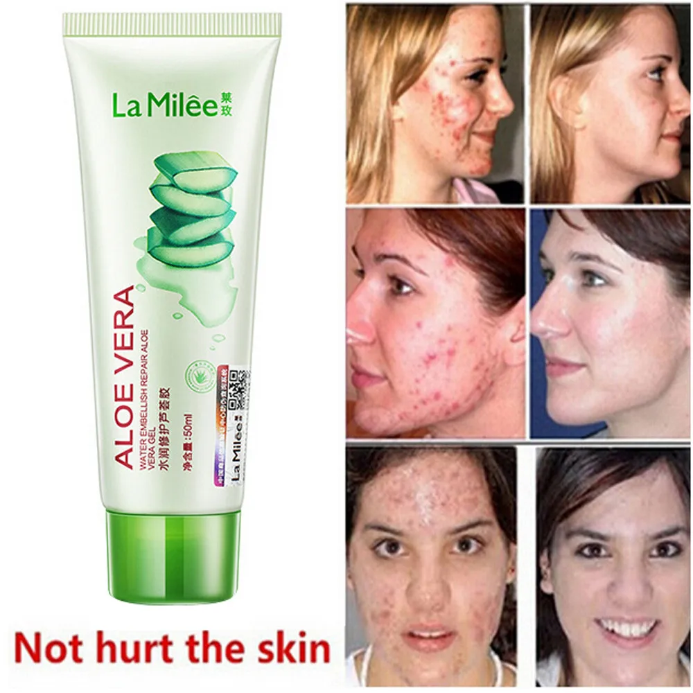 Новинка 2018 эффективный крем для ухода за кожей лица удаления акне пятна шрам