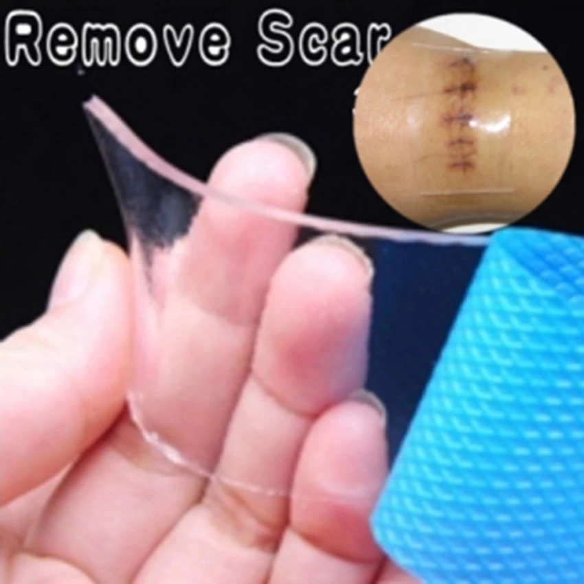 1 шт. силиконовый Патч Бесплатная доставка шрам удаление силикона для удаления