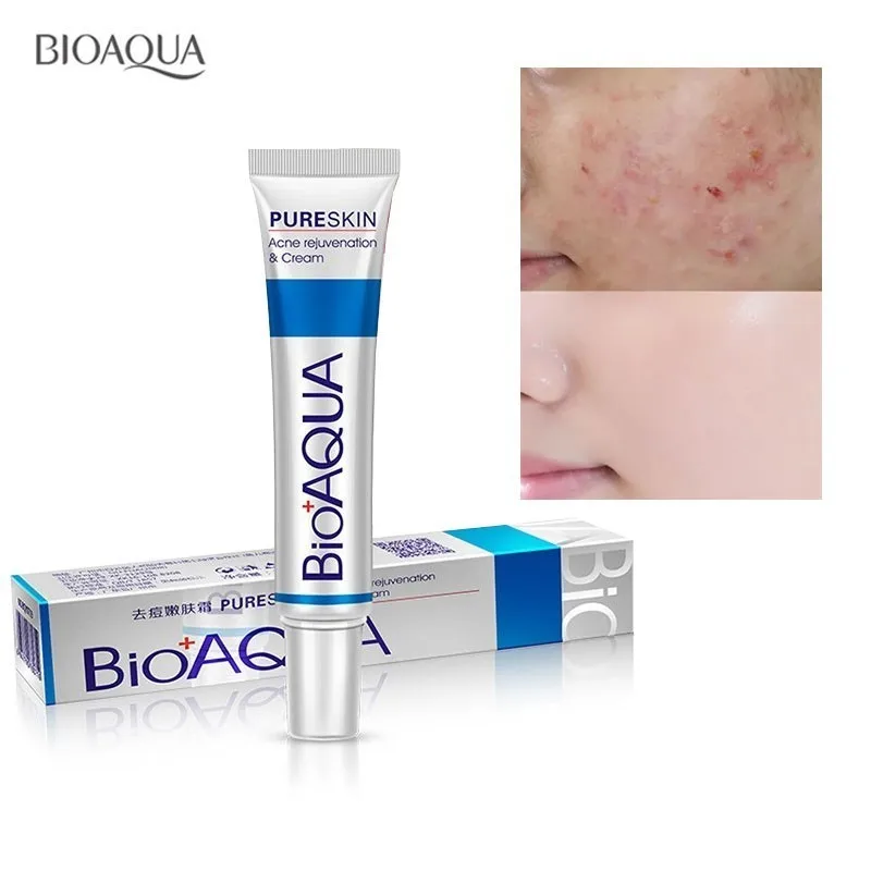 

Bioaqua 30g Acne Removal Cream Acne Treatment Fade Acne Spots Oil Control Shrink Pores Whitening Moisturizing Face Skin Care