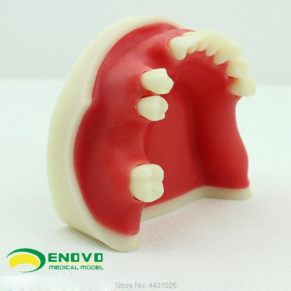 

ENOVO The dental implant teaching of dental implant was simulated