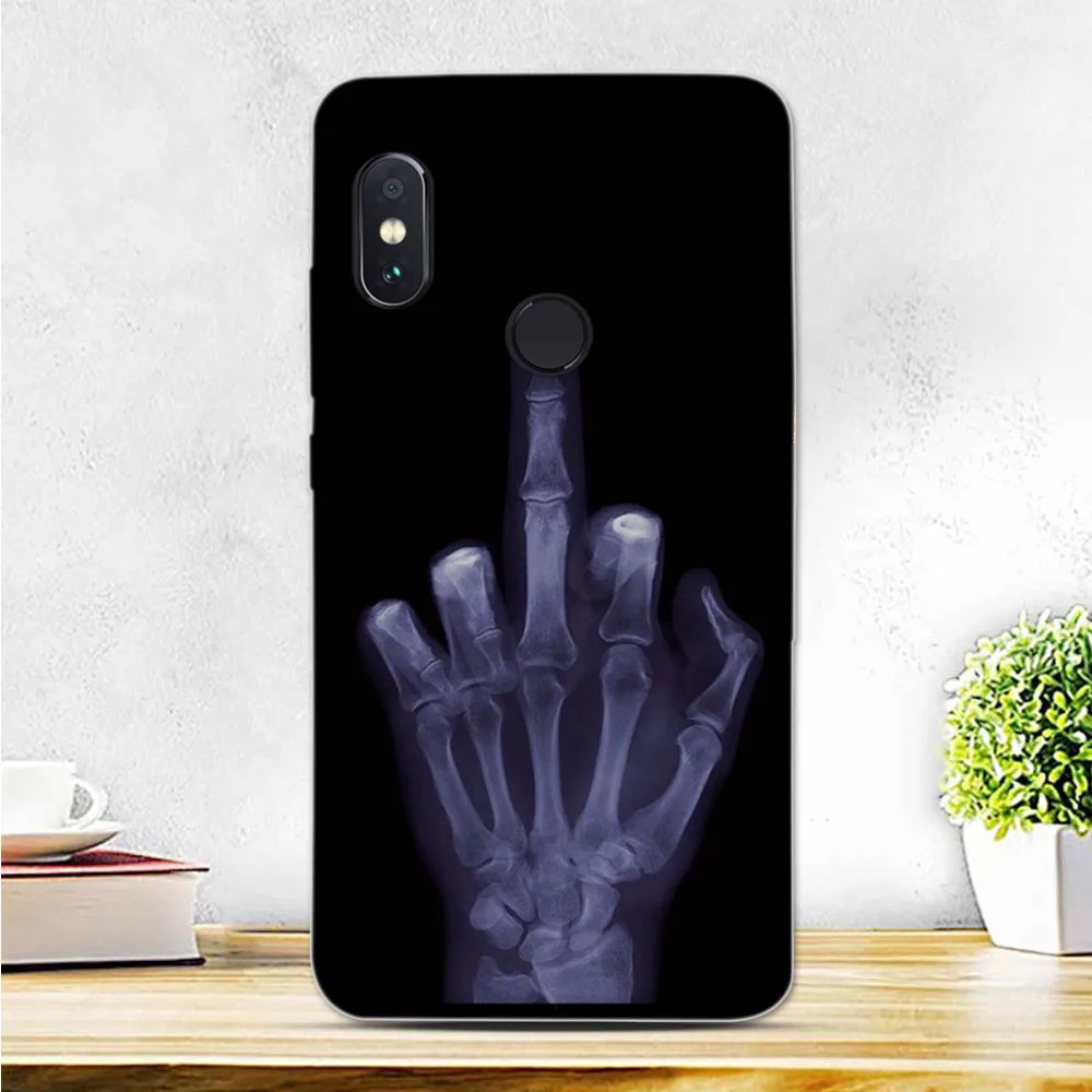Чехол для Xiaomi Redmi Note 5 чехол Pro 99 дюйма Мягкая силиконовая задняя крышка из ТПУ