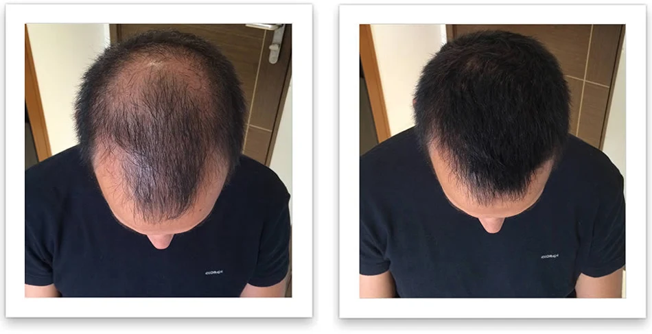 30ml Hair Growth Serum Essence Spray for Women and Men Anti Prevent Hair Loss alopecia Liquid Damaged Hair Growth Liquid