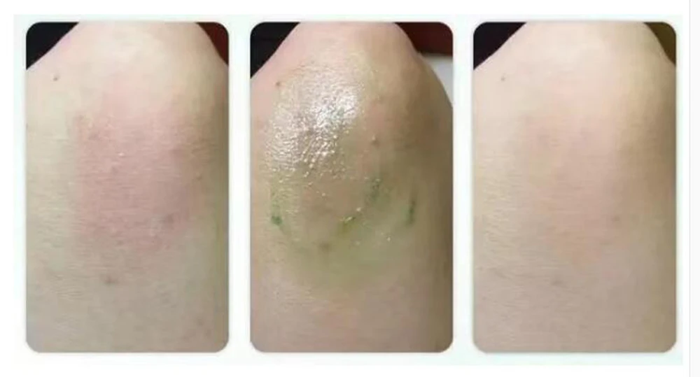 15g Napattiga Green herbal Balm Ointment Thailand Grass Ointment Muscle Pain Relief Ointment Soothe itchy mosquite bite scald