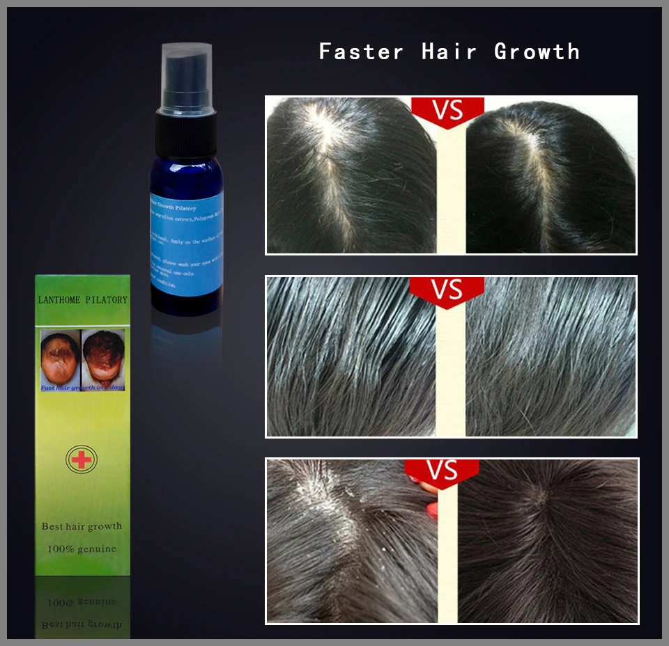 New Hair Growth Liquid Spray Product 30ml Yuda Alopecia Pilatory Extra Strength Anti Loss Of Regrowth Treatment Serum |