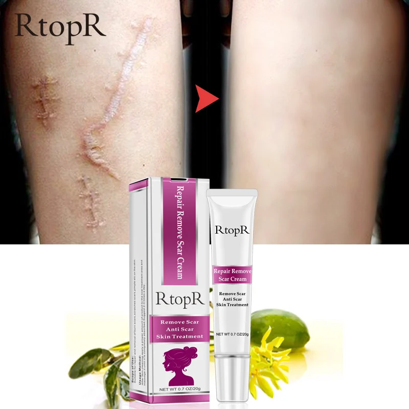 RtopR крем для удаления шрамов от акне и растяжек отбеливающий угрей
