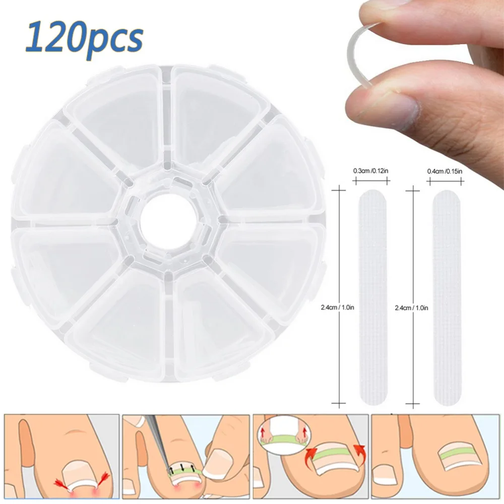 120pcs/Box Ingrown Toenail Straightening Clip Brace Toenails Thick Paronychia Acronyx Correction Patch Foot Care Tool #265508 | Красота и