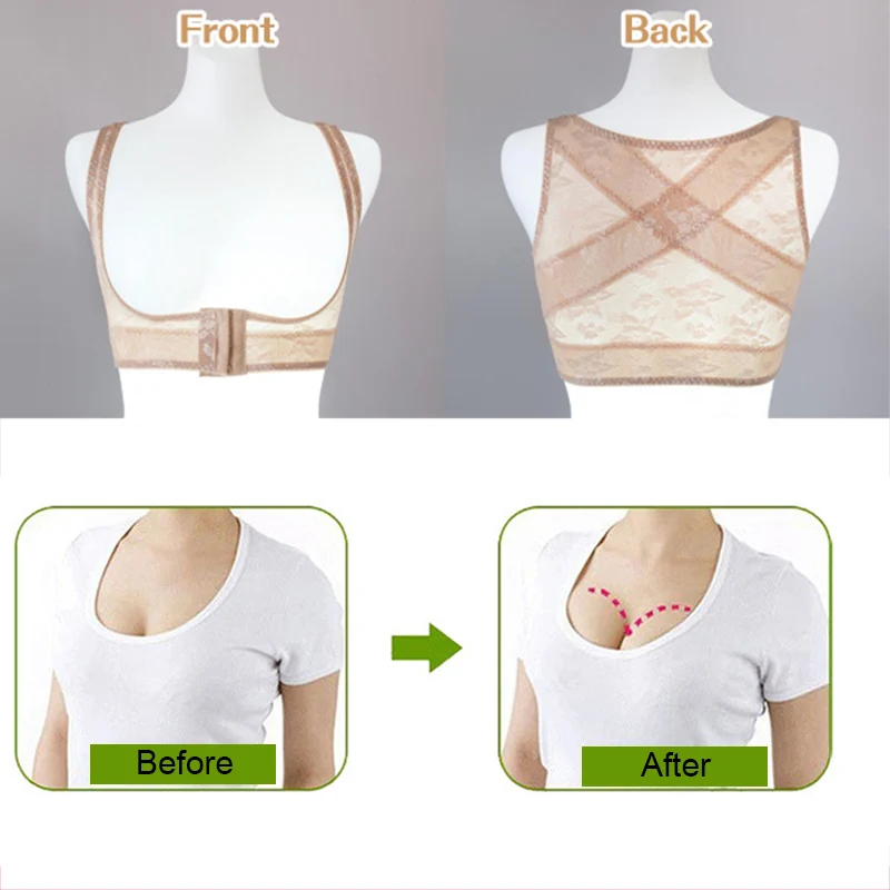 Корректор осанки для спины женщин корсет груди предотвращающий горб дышащий