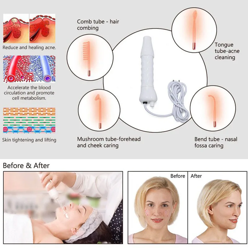 Ручной высокочастотный аппарат для лица спа-массаж расслабление удаление пятен