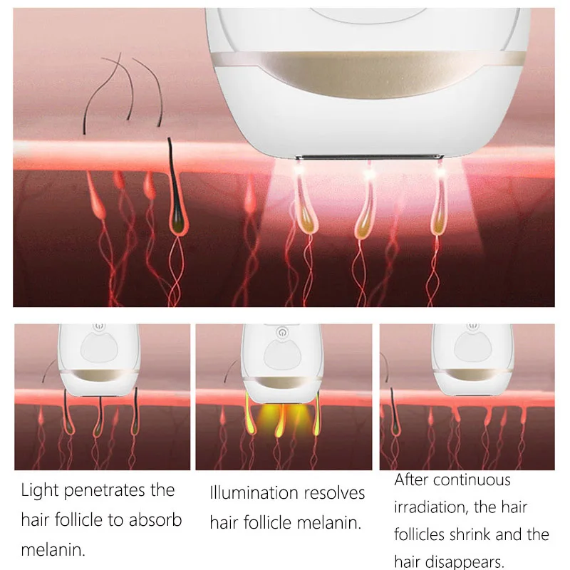 

300000 Times IPL Epilator Laser hair removal Permanent Laser epilasyon Hair Removal Machine For Body