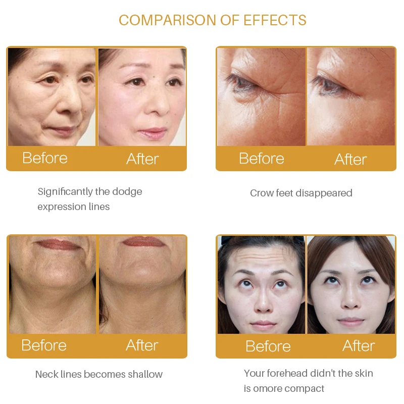 

5Pcs efero Six Peptides Collagen Serum Anti Wrinkle Cream Face Care Essence Anti Aging Moisturizing Whitening Cream