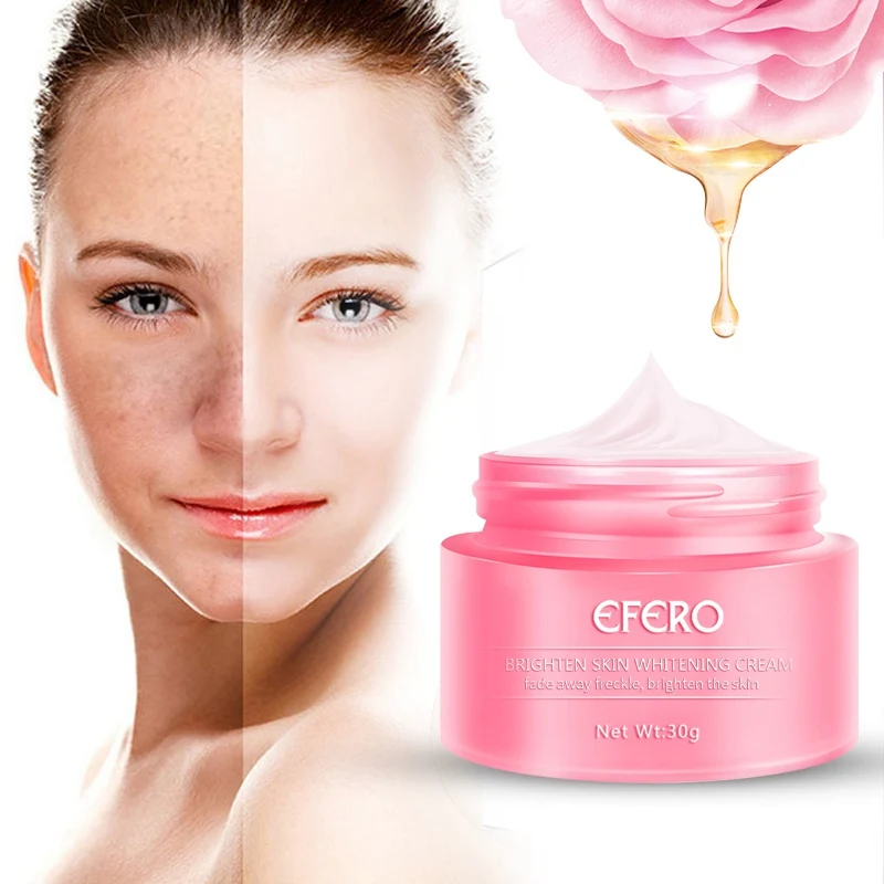 

30g Remove Freckles Cream Powerful Whitening Freckle Cream 40g Remove Melasma Acne Spots Pigment Melanin Moisturizing Skin Care
