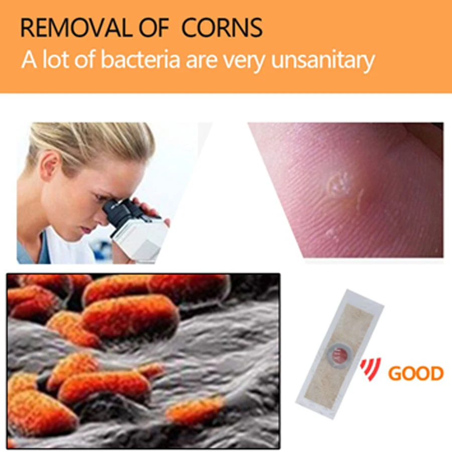 6 шт. медицинские штукатурки для удаления мозолей ног бородавки шип штукатурка