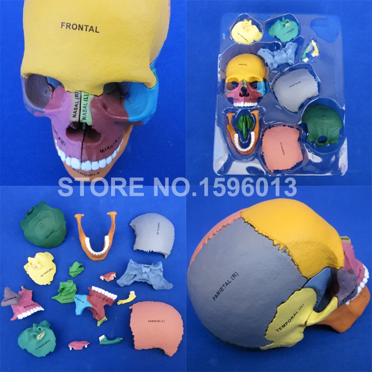 Усовершенствованная модель черепа с дисперзирующей костью человеческого в