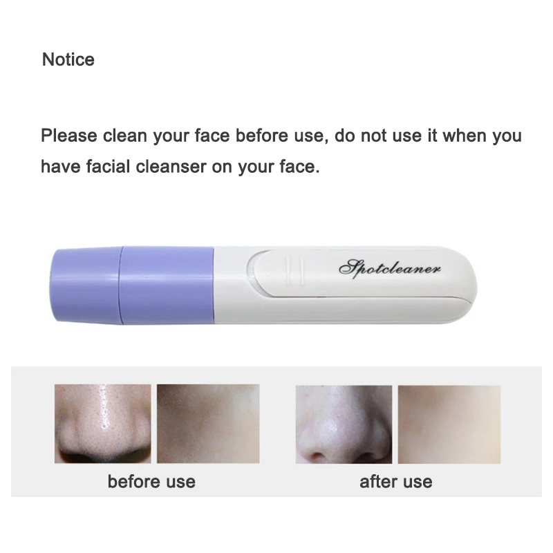 Электрический мини массажер для лица очищающее средство пор грязи прыщей акне