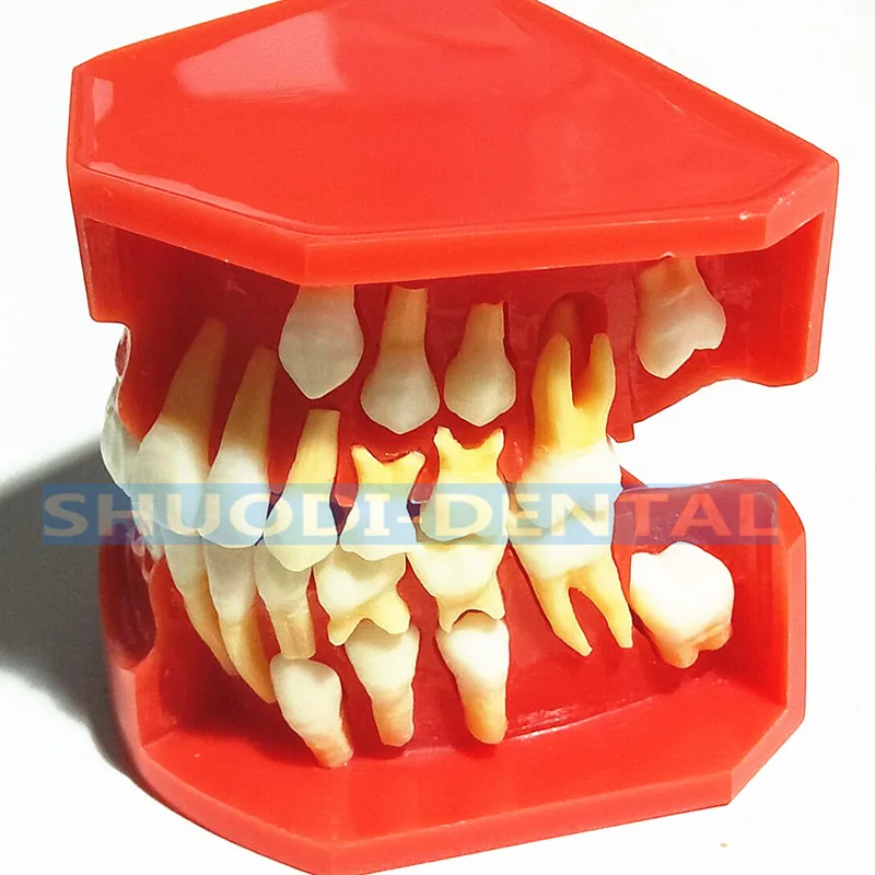 E Children Tooth Стоматологическая Исследование Учебная модель стоматологического Стандартный модель съемные зубы для взрослых и детей TYPODONT модель Стоматолог Связь модель - Цвет: E Children Tooth