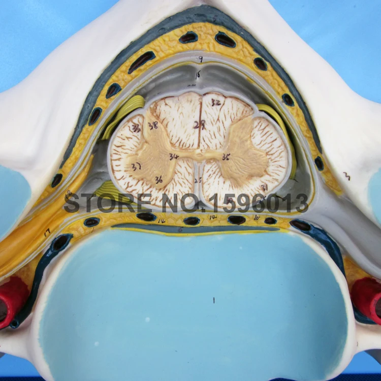 Горячая пятая Шейная позвонка с спинновым и нервным соединением Φ|cord toggle|vertebrae