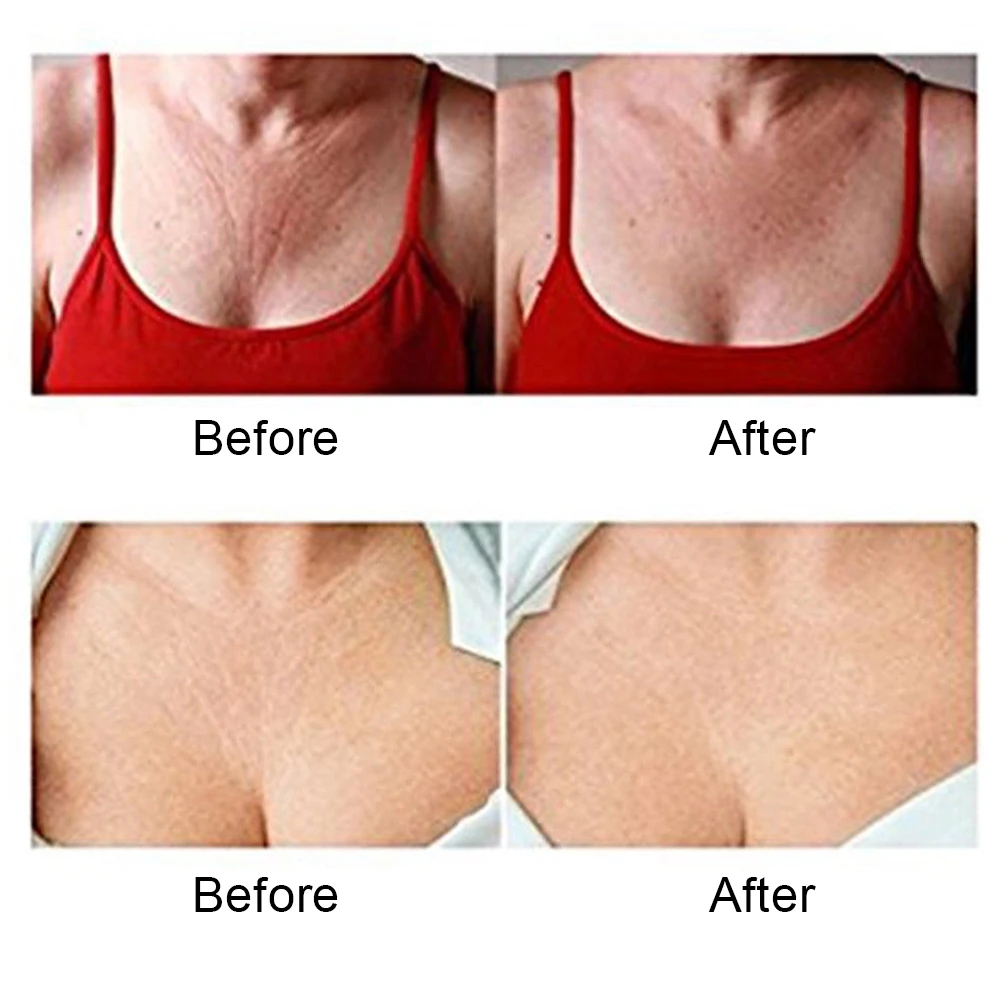 1 шт. многоразовая силиконовая подушечка в форме сердца против морщин Прозрачная