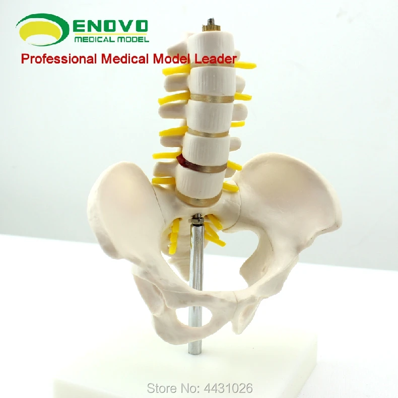 ENOVO A small pelvis with five lumbar spine models of the spine model of the orthopedic model of the human .skeleton enovo standard female pelvic gynecological examination model of human bone specimen pelvis measurement model