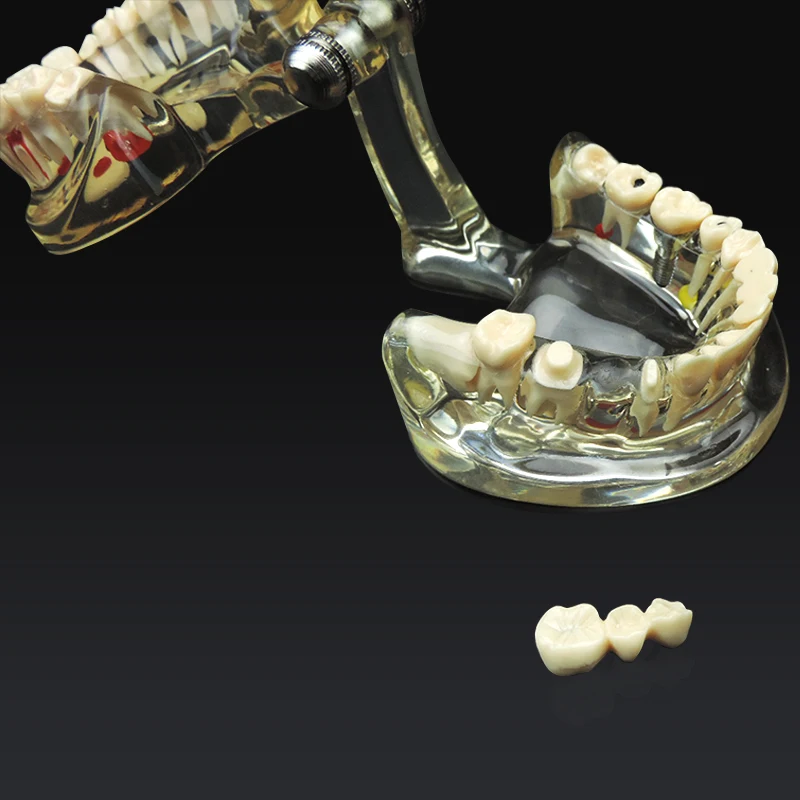 Модель зубов для обучения патологии и заболеваниям взрослых модель съемная