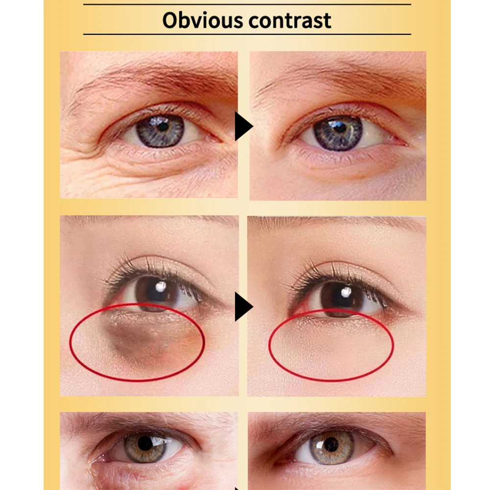 1PC 24k Golden Moisturizing Eye Serum Collagen Anti-Aging Face Anti Puffiness Dark Circle Repair Tighten skin Around Eyes | Красота и