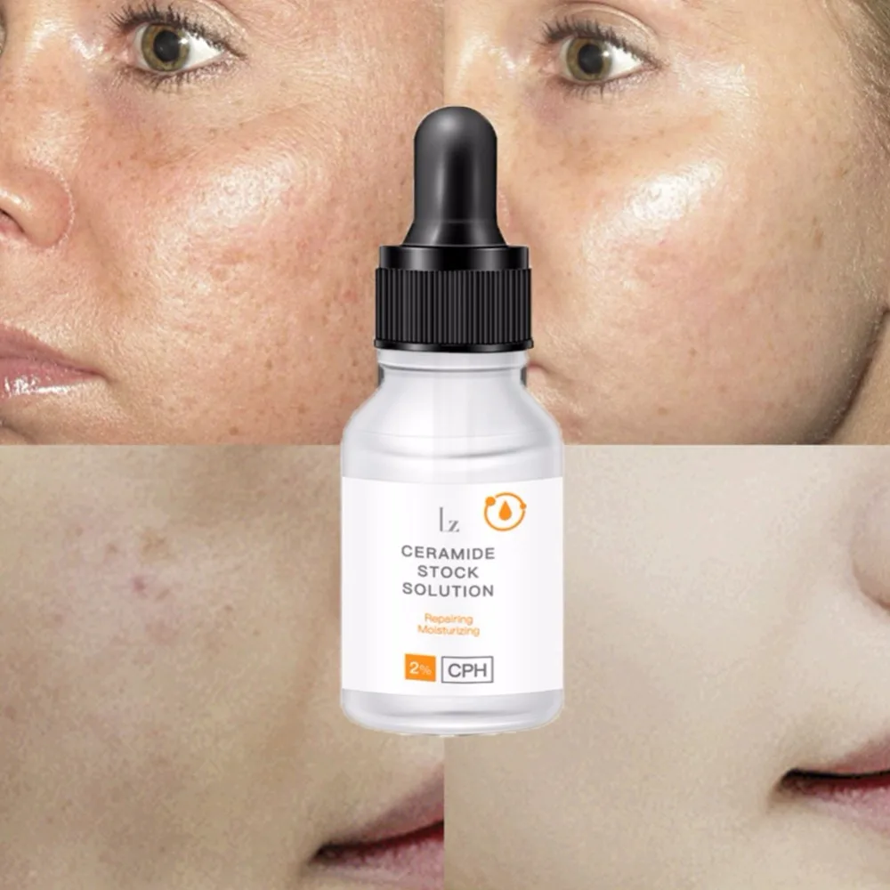 Ceramide Сыворотка увлажняющая фиксатор воды ровные тонкие линии подтяните кожу против высыхания лица Эфирная жидкость