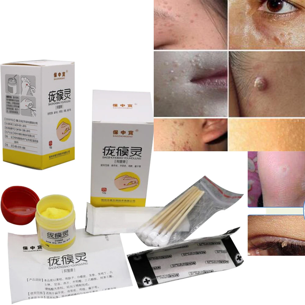 Средство для удаления кожных тегов 12 часов Tu kill Medical Remover Skin Tag Mole & Genital средство