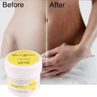 skin body maternity cream stretch marks remover scar removal powerful postpartum pregnancy cream 30g