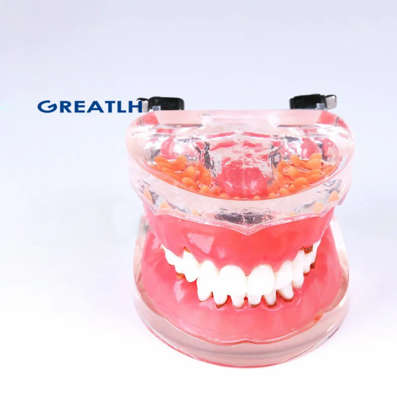 Стоматологические взрослые патологические пародонтальные заболевания 4017 #