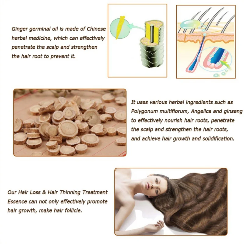 

7 Days Ginger Hair Essential Oil Hair Care Essence Hairs Essential Oils Dry Hair Lost Products 30ml Hot