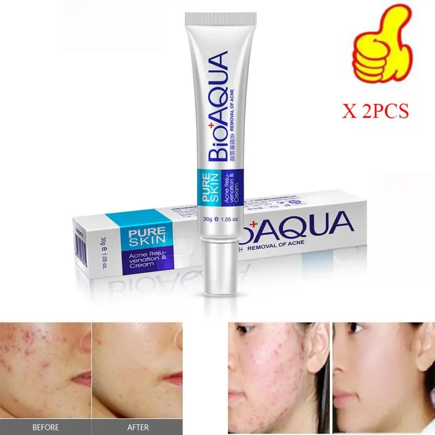 Крутой! 2 шт. эффективный крем для ухода за кожей лица удаления акне пятен шрам