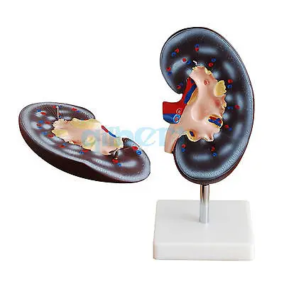 2 раза увеличенные почки человека с надпочечными железными анатомическими