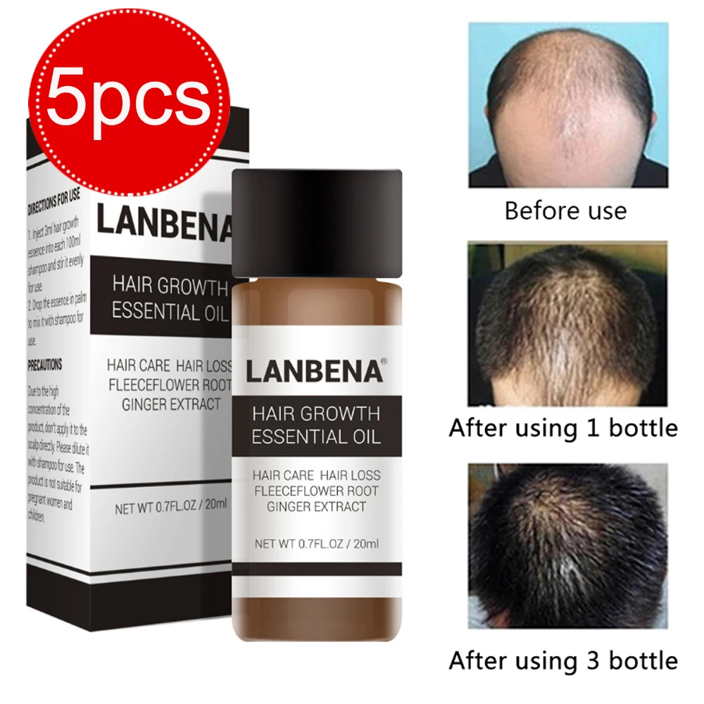 LANBENA 5 шт./компл. Уход за волосами для более быстрого роста плотное эфирное масло