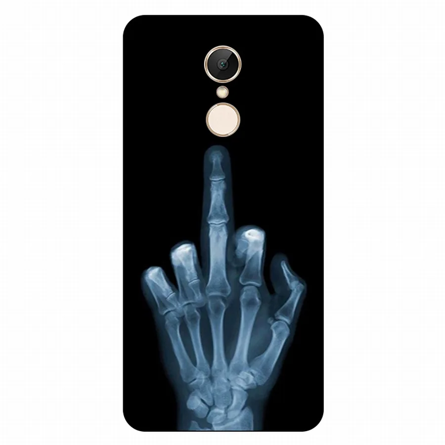 Soft Cases For Xiaomi Redmi5 Transparent Printing Drawing Phone Cover redmi 5 Silicone for REDMI | Мобильные телефоны и