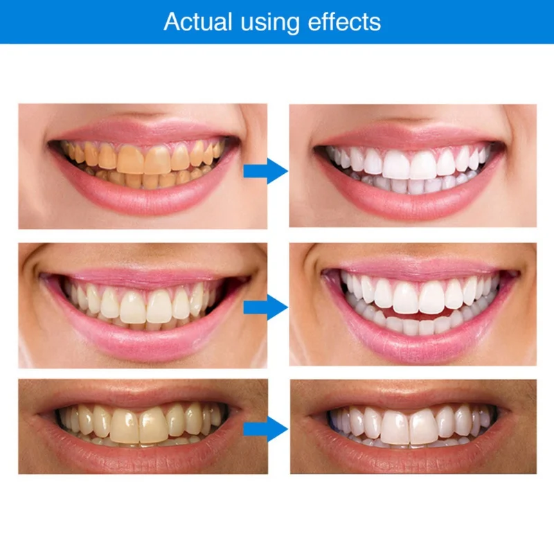 6 мл эффективное отбеливание зубов ручка отбеливающий гель для ухода за зубами
