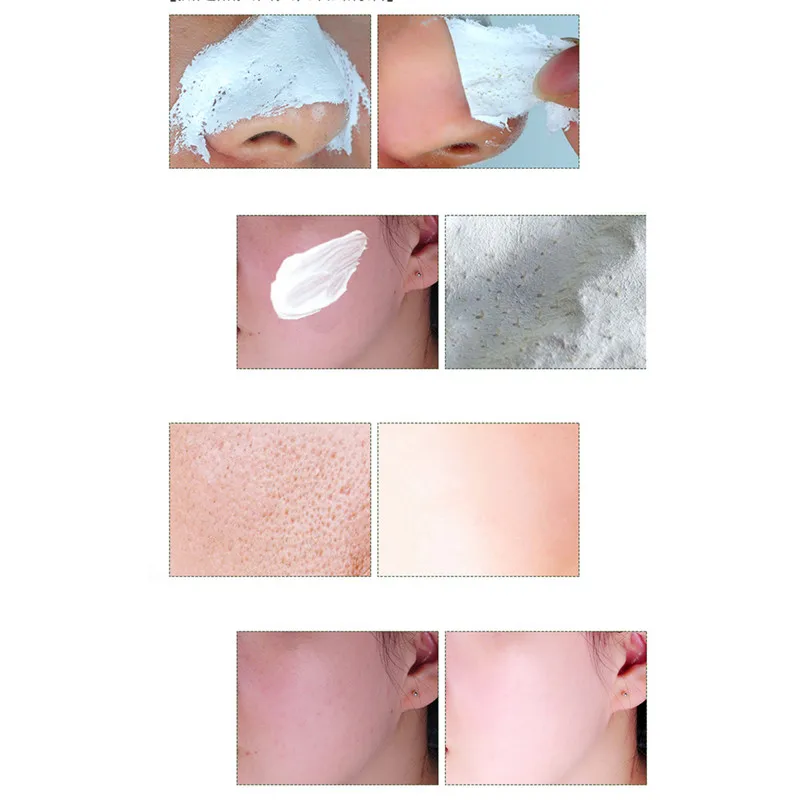 10 шт./лот маска для ухода за лицом белая удаления черных точек в носу Очищающая
