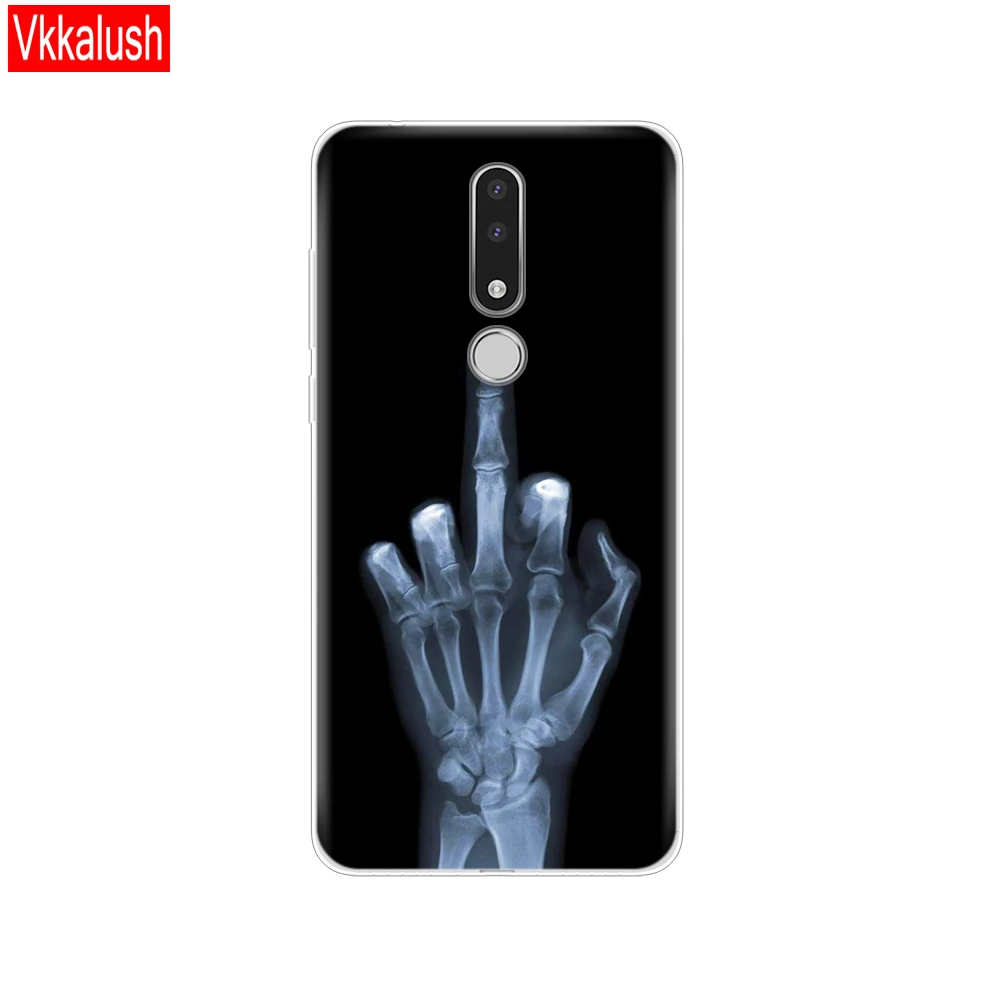 80184 Чехол для телефона Nokia 3,1 Plus, чехол, Забавный мультяшный силиконовый мягкий чехол на заднюю панель Nokia3.1 для Nokia 3,1 Plus, чехол, сумка bock - Color: 80184