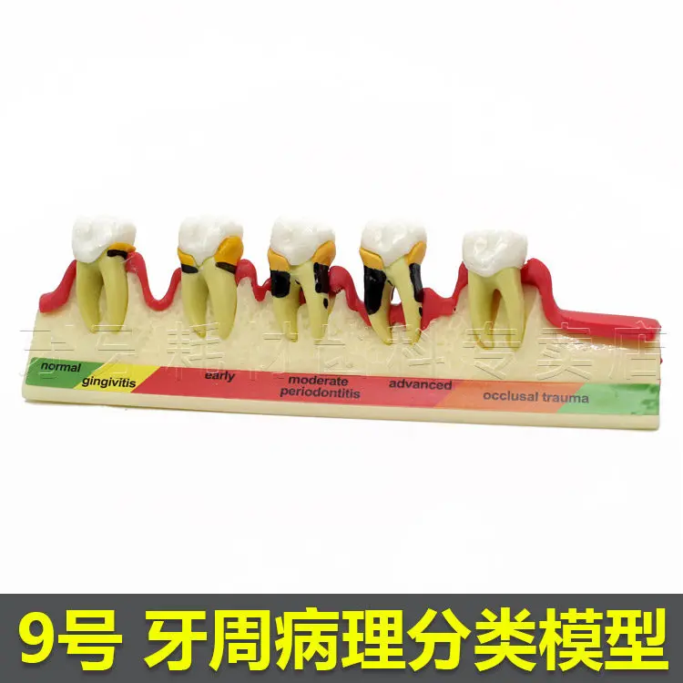 Фото Стандартное заболевание зубной тип модель 1 шт|typodont models|dental periodonticsdental tooth |